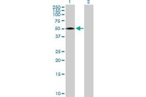 Western Blot analysis of RCN2 expression in transfected 293T cell line by RCN2 MaxPab polyclonal antibody. (RCN2 Antikörper  (AA 1-317))