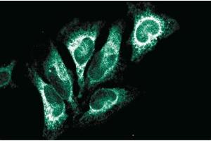 Image no. 3 for anti-Heme Oxygenase (Decycling) 1 (HMOX1) (AA 150-286) antibody (ABIN968130)
