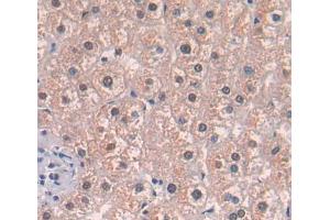Used in DAB staining on fromalin fixed paraffin- embedded liver tissue (Acetyl-CoA Carboxylase beta Antikörper  (AA 29-249))