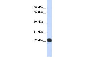 WB Suggested Anti-RCVRN Antibody Titration:  0. (Recoverin Antikörper  (N-Term))