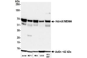 Western Blotting (WB) image for anti-Mdm4-binding Protein (MDM4) (AA 125-175) antibody (ABIN7795618) (Rekombinanter MDM4-binding Protein Antikörper  (AA 125-175))