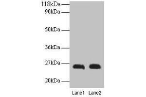 Western blot All lanes: CSH1 antibody at 2 μg/mL Lane 1: A549 whole cell lysate Lane 2: U251 whole cell lysate Secondary Goat polyclonal to rabbit IgG at 1/15000 dilution Predicted band size: 26 kDa Observed band size: 26 kDa (CSH1 Antikörper  (AA 27-217))