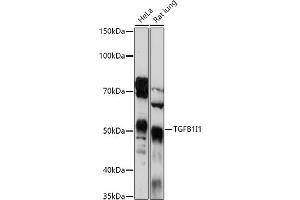 Western blot analysis of extracts of various cell lines, using TGFB1I1 antibody (ABIN6129144, ABIN6149074, ABIN6149075 and ABIN6224526) at 1:1000 dilution. (TGFB1I1 Antikörper  (AA 1-150))
