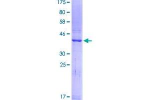 REG1A Protein (AA 1-166) (GST tag)