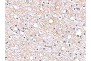 Immunohistochemical staining of human brain tissue using PLXDC2 polyclonal antibody  at 2. (PLXDC2 Antikörper  (N-Term))