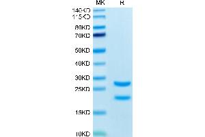 Biotinylated Rat MASP2 on Tris-Bis PAGE under reduced condition. (MASP2 Protein (AA 287-685) (His tag,Biotin))