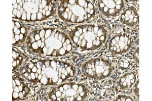 IHC analysis of HGS using anti-HGS antibody (ABIN7601205). (HGS Antikörper  (AA 3-777))