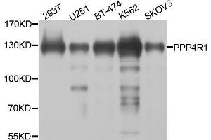 Western blot analysis of extracts of various cell lines, using PPP4R1 antibody. (PPP4R1 Antikörper)
