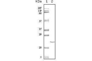 Western blot analysis using cTnI mouse mAb against truncated cTnI recombinant protein.