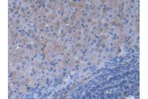 DAB staining on IHC-P; Samples: Mouse Ovary Tissue (VARS Antikörper  (AA 186-421))