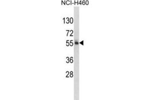 Western Blotting (WB) image for anti-Fat Mass and Obesity-Associated (FTO) antibody (ABIN3002909) (FTO Antikörper)