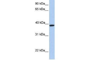 Aquaporin 10 antibody used at 1 ug/ml to detect target protein.