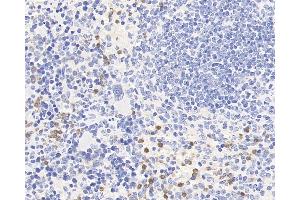 Immunohistochemistry analysis of paraffin-embedded mouse spleen using CCR5 Polyclonal Antibody at dilution of 1:300. (CCR5 Antikörper)