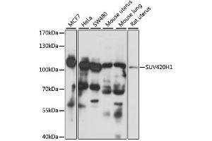 Western blot analysis of extracts of various cell lines, using SUV420H1 antibody. (SUV420H1 Antikörper)