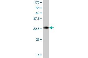 Western Blot detection against Immunogen (33. (ATOX1 Antikörper  (AA 1-68))