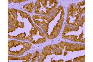 Immunohistochemistry (Paraffin-embedded Sections) (IHC (p)) image for anti-Folate Hydrolase (Prostate-Specific Membrane Antigen) 1 (FOLH1) (AA 44-750) antibody (ABIN1302364)