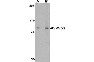 Western blot analysis of VPS53 in 293 cell lysate with VPS53 antibody at (A) 0. (VPS53 Antikörper  (C-Term))