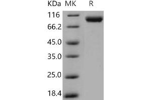 Western Blotting (WB) image for Vascular Cell Adhesion Molecule 1 (VCAM1) (Active) protein (His tag) (ABIN7198676) (VCAM1 Protein (His tag))