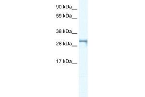 WB Suggested Anti-SHOX2 Antibody Titration: 0. (SHOX2 Antikörper  (Middle Region))