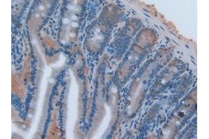 DAB staining on IHC-P; Samples: Rat Intestine Tissue (TNFSF14 Antikörper  (AA 58-239))
