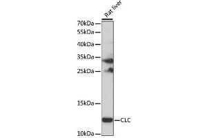 Western blot analysis of extracts of Rat liver, using CLC antibody (ABIN6292448) at 1:1000 dilution. (Galectin 10 Antikörper)
