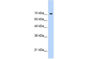 WB Suggested Anti-STAT1 Antibody Titration:  0. (STAT1 Antikörper  (C-Term))