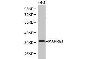 Western Blotting (WB) image for anti-Ankyrin Repeat and Sterile alpha Motif Domain Containing 1B (ANKS1B) antibody (ABIN1873638) (ANKS1B Antikörper)