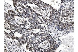 IHC analysis of PRDM14 using anti-PRDM14 antibody (ABIN7603152). (PRDM14 Antikörper  (N-Term))