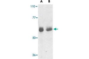 Western blot analysis of TRAF3IP2 expression in human lung (lane A) and placenta (lane B) tissue lysates with TRAF3IP2 polyclonal antibody  at 1 ug /mL . (TRAF3IP2 Antikörper  (AA 2-15))