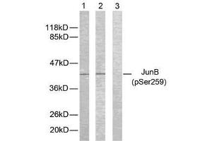 Western blot analysis of extracts from HeLa cells using JunB (phospho-Ser259) antibody (E011027). (JunB Antikörper  (pSer259))