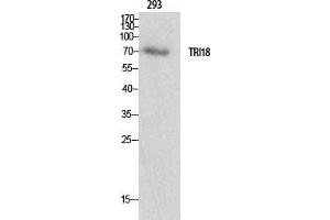 Western Blot (WB) analysis of specific cells using Midline-1 Polyclonal Antibody. (MID1 Antikörper  (N-Term))