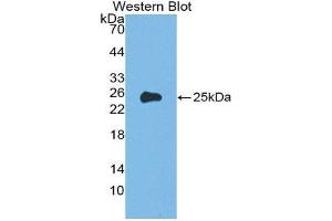 Western Blotting (WB) image for anti-Orosomucoid 1 (ORM1) (AA 19-201) antibody (ABIN1857834) (ORM1 Antikörper  (AA 19-201))