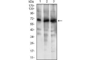 Western Blotting (WB) image for anti-ATP-Binding Cassette, Sub-Family G (WHITE), Member 5 (ABCG5) (AA 306-367) antibody (ABIN1845666)