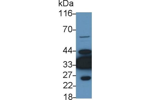 LDHB anticorps  (AA 1-334)