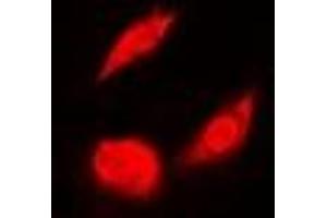 Immunofluorescent analysis of OSGEP staining in A549 cells.