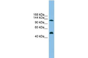 WB Suggested Anti-GART Antibody Titration: 0. (GART Antikörper  (Middle Region))