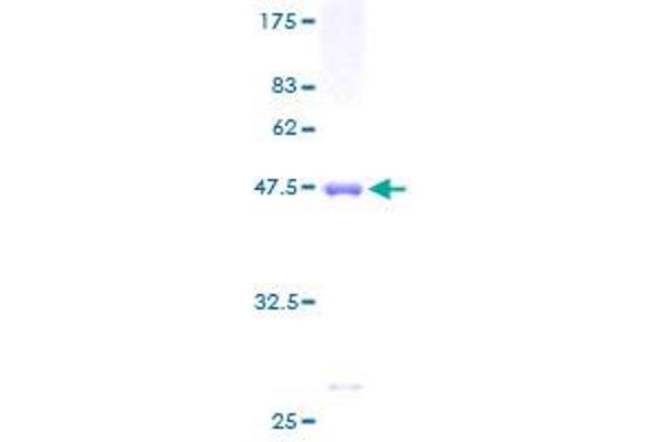 YKT6 Protein (AA 1-198) (GST tag)