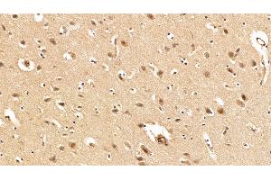 Immunohistochemistry (IHC) image for anti-TAR DNA Binding Protein (TARDBP) (AA 104-262) antibody (ABIN7434404)