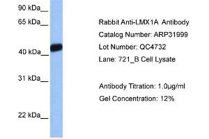 Western Blotting (WB) image for anti-LIM Homeobox Transcription Factor 1, alpha (LMX1A) (Middle Region) antibody (ABIN182469) (LMX1A Antikörper  (Middle Region))