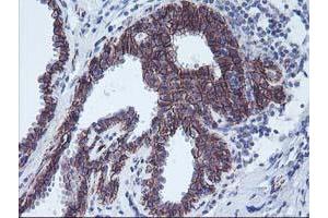 Immunohistochemical staining of paraffin-embedded Human breast tissue using anti-ALOX15 mouse monoclonal antibody.