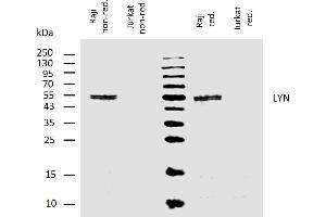 Western blotting analysis of human LYN using mouse monoclonal antibody LYN-01 on lysates of Raji cell line and Jurkat cell line (LYN non-expressing cell line, negative control) under non-reducing and reducing conditions. (LYN Antikörper  (AA 8-238))
