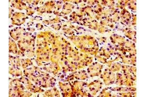 Immunohistochemistry of paraffin-embedded human pancreatic tissue using ABIN7156829 at dilution of 1:100 (IL18R1 Antikörper  (AA 22-128))