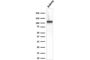 Western Blot Analysis of Human Kidney lysate using CDH16-Monospecific Mouse Monoclonal Antibody (CDH16/2125) (Cadherin-16 Antikörper  (AA 371-507))