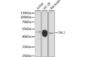 Western blot analysis of extracts of various cell lines, using T antibody (ABIN6132557, ABIN6148834, ABIN6148835 and ABIN6216741) at 1:3000 dilution. (TAL1 Antikörper  (AA 242-331))