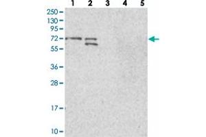 Western blot analysis of Lane 1: RT-4, Lane 2: U-251 MG, Lane 3: Human Plasma, Lane 4: Liver, Lane 5: Tonsil with BRAP polyclonal antibody  at 1:100-1:250 dilution. (BRAP Antikörper)