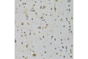 Immunohistochemistry of paraffin-embedded rat brain using DDX1 Antibody (ABIN5973950) at dilution of 1/100 (40x lens). (DDX1 Antikörper)
