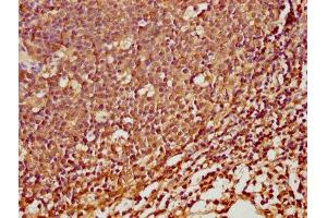 IHC image of ABIN7168929 diluted at 1:100 and staining in paraffin-embedded human tonsil tissue performed on a Leica BondTM system.