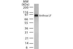 Image no. 1 for anti-Anthrax Toxin Lethal Factor (Lef) (AA 779-792) antibody (ABIN200035) (Anthrax Toxin Lethal Factor Antikörper  (AA 779-792))