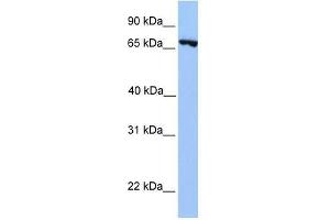 PRDM6 antibody used at 0. (PRDM6 Antikörper  (N-Term))
