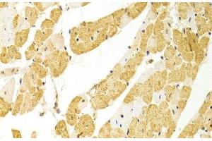 Immunohistochemistry of paraffin-embedded Rat heart using PLCB1 Polyclonal Antibody at dilution of 1:100 (40x lens).